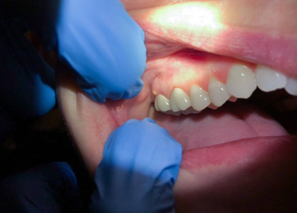 Best Emergency Dental Care for Trauma or Injury in West Kennebunk, ME